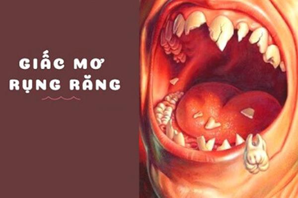 Nằm mơ thấy gãy răng đánh con gì. Giải mã giấc mơ rụng răng
